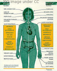 symptoms of hypothyroidism